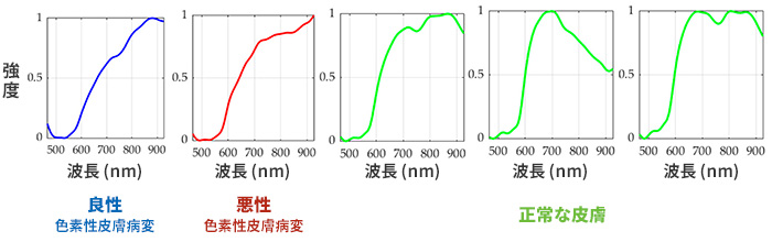 「正常な肌」と「色素性皮膚病変（良性・悪性）」のスペクトルデータ
