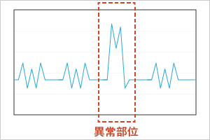 異常部位検知