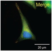 TLS-application-medical-life-sience